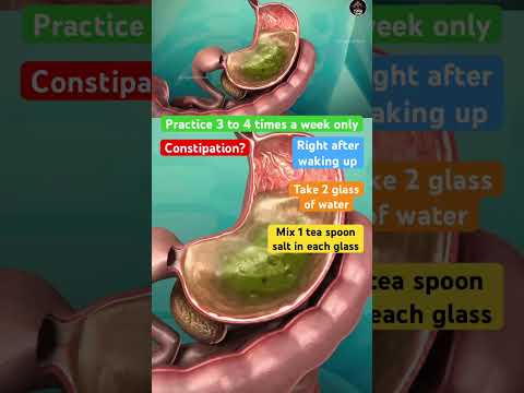 🔥Clean Colon from Stuck Old Poop #ibs #colon #cleaning #constipation