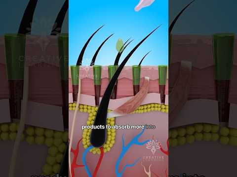How a Derma Roller Can Boost Your Hair Growth #shorts #microneedling – creativelearning3d