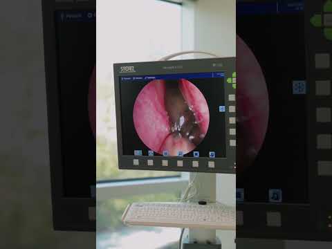 WHAT IS THAT?! #ent #entsurgery #hearingloss #nasalcongestion #sinusinfection #sinusitis #nose
